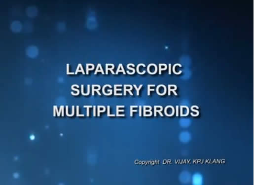 laparoscopic surgery