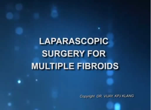 Laparoscopic Surgery