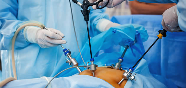 Minimally Invasive Surgery